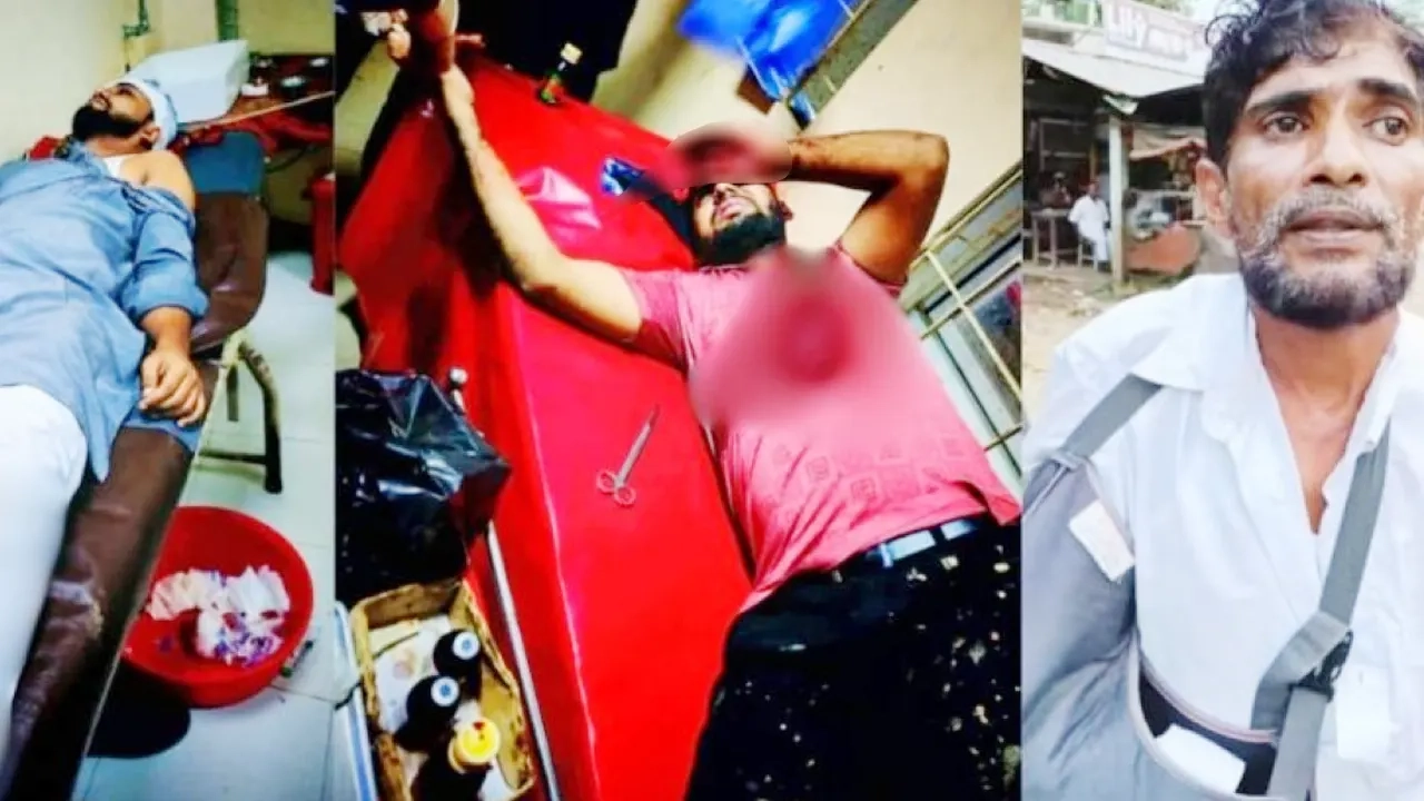 আহত কয়েকজনকে হাসপাতালে ভর্তি করা হয়