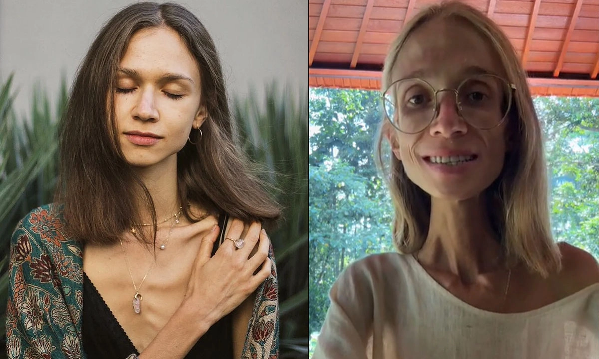 অতিরিক্ত ফল খেয়ে স্লিম হবার চেষ্টা, মারা গেলেন তরুণী