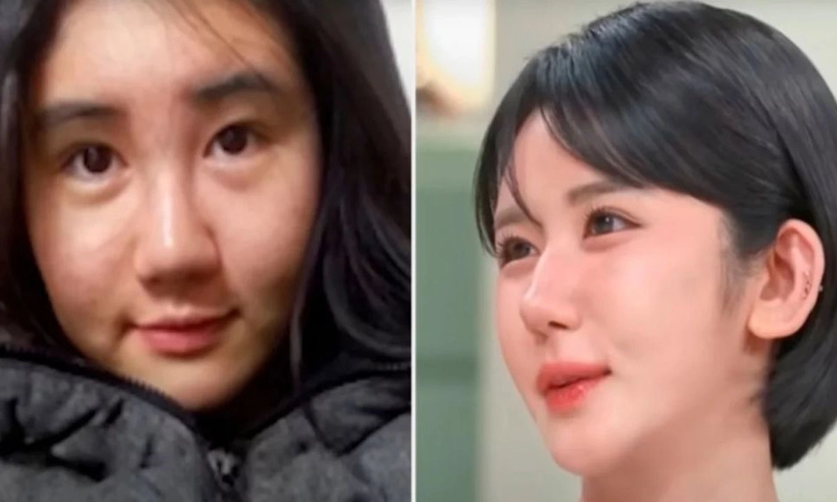 ১৫ বছরে ৪০০ কসমেটিক সার্জারি এই তরুনী