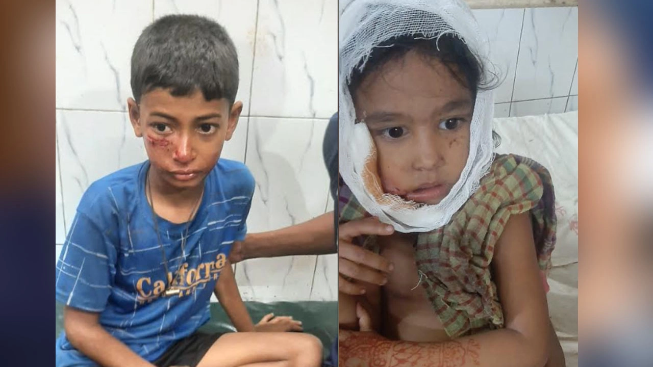 বানিয়াচংয়ে শিয়ালের কামড়ে ৩ জন আহত