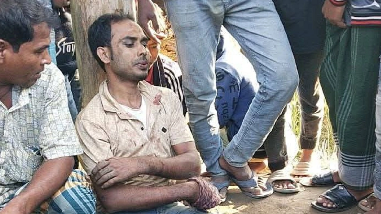 যুবদল নেতাকে চোর সন্দেহে পিটিয়ে তার বাম ভেঙে পা দিয়েছে স্থানীয়রা।