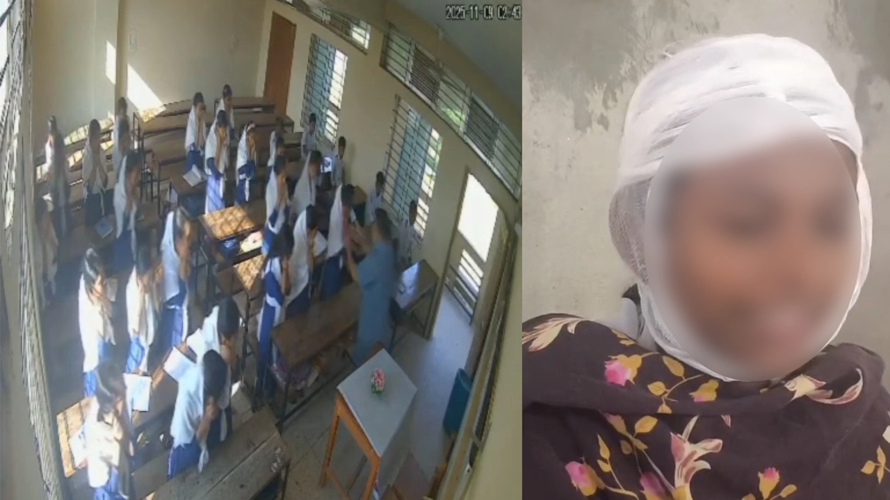 শিক্ষকের ছোড়া ডাস্টারের আঘাতে আহত হওয়া শিক্ষার্থী