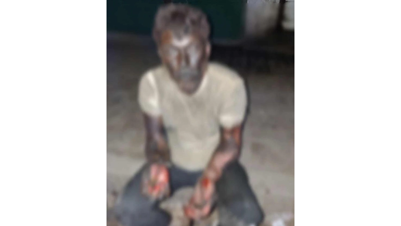 দগ্ধ চালক