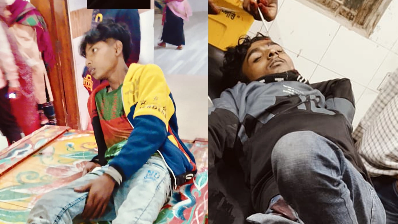 আহত মোটরসাইকেল আরোহী