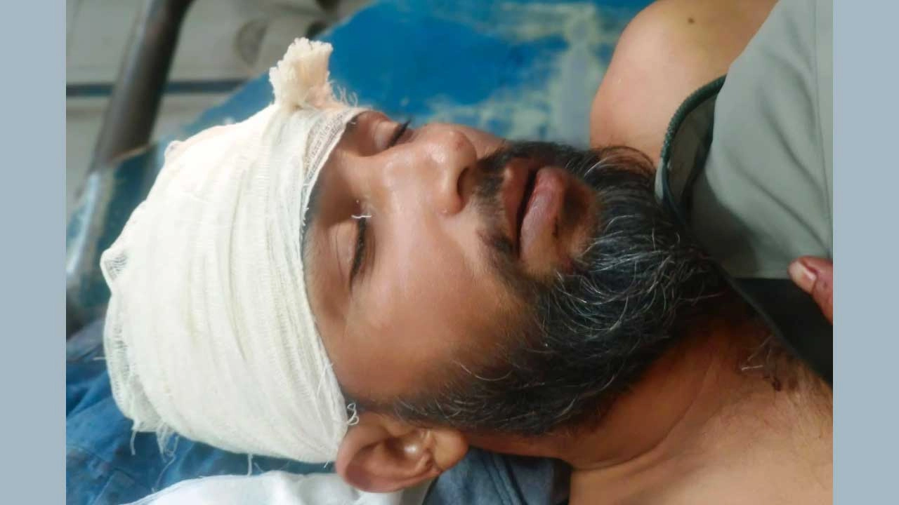 মোতালেব শিকদার গুলিবিদ্ধ