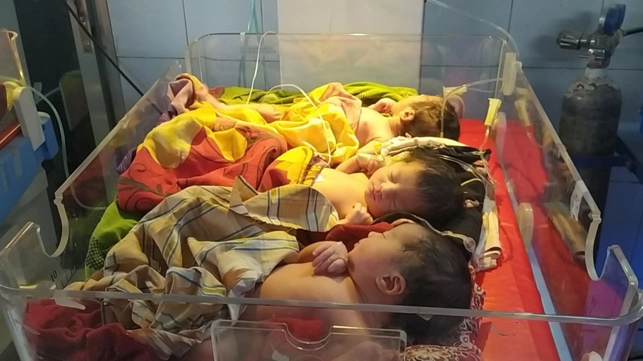 একসঙ্গে জন্ম নেয়া তিন শিশু