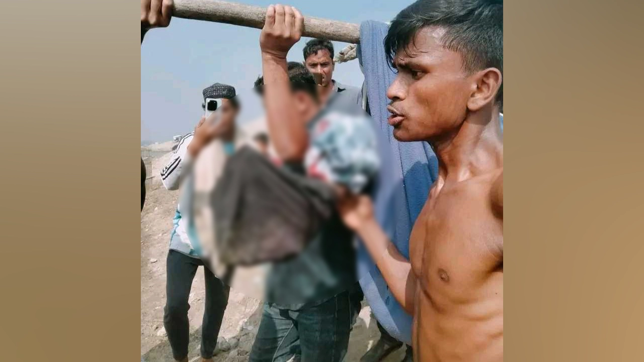 মাইন বিস্ফোরণে জেলের পা বিচ্ছিন্ন