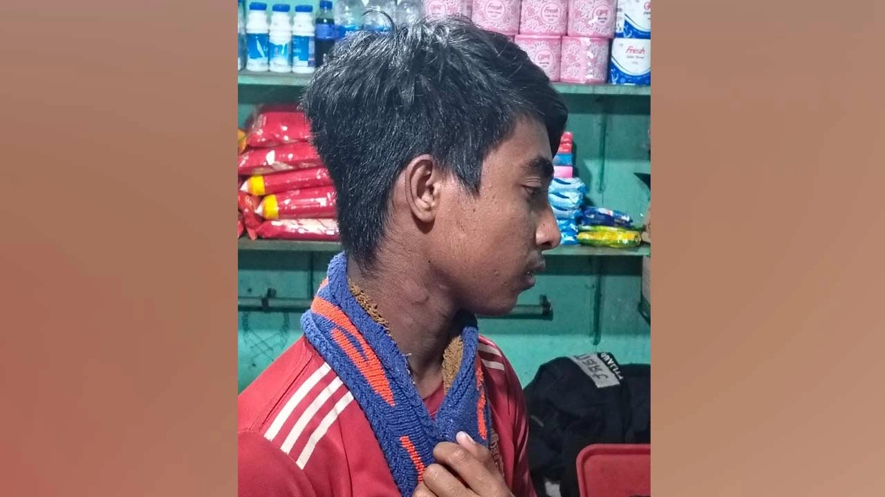 আহত শিশু