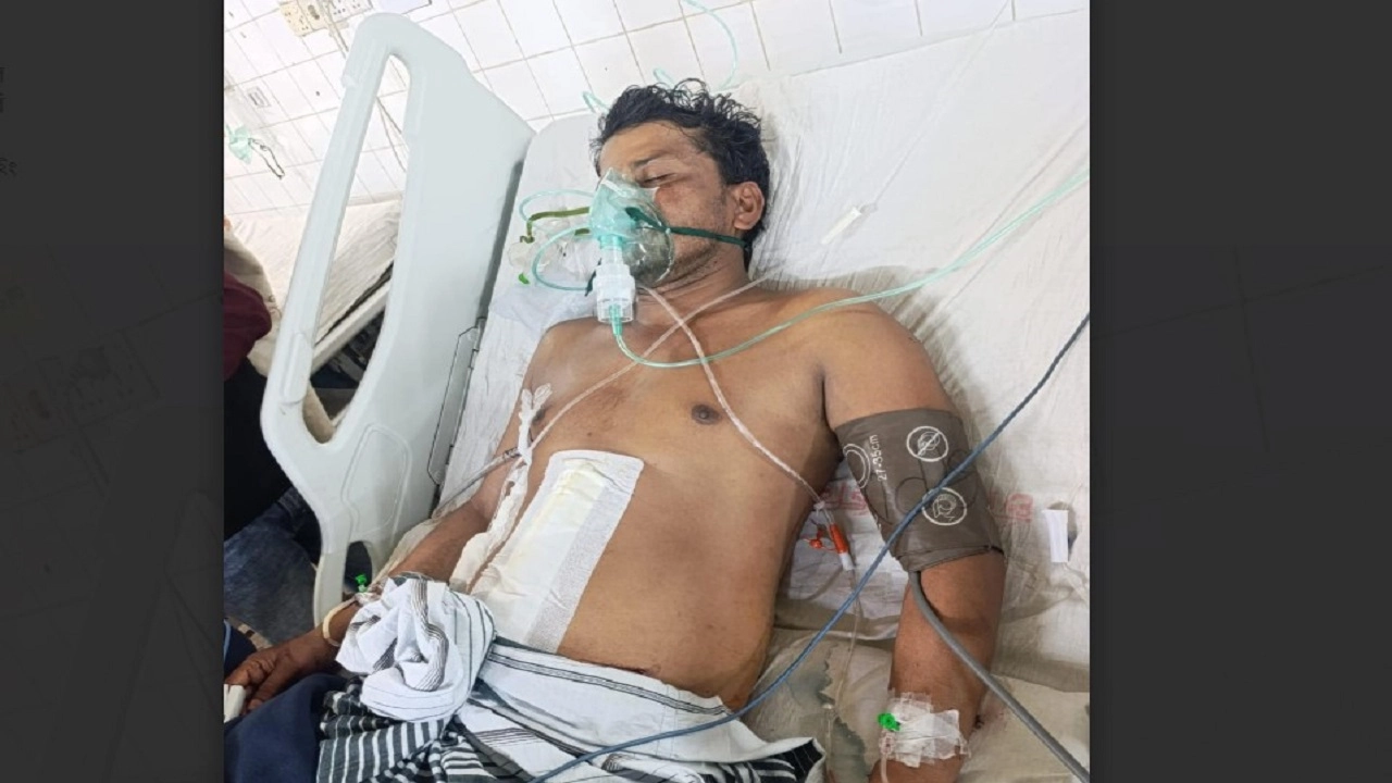 আহত আব্বাস চৌধুরীর মৃত্যু