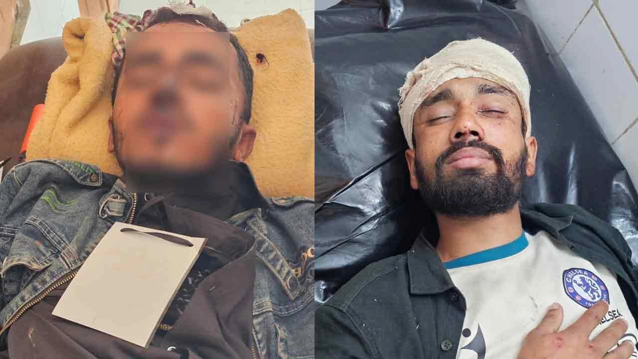 জামায়াত-বিএনপির সংঘর্ষে আহত নেতাকর্মী