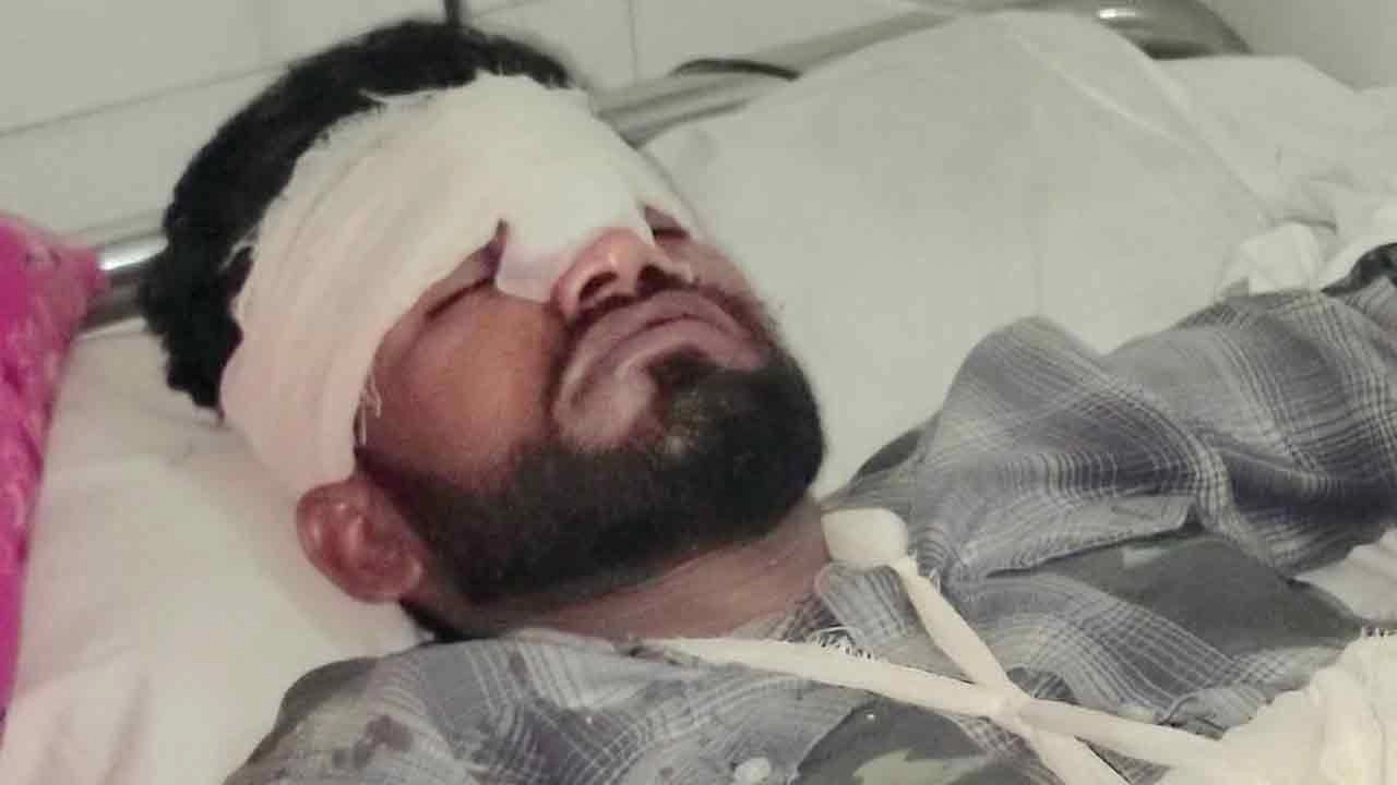 আহত যুবদল নেতা রাজু আহাম্মেদ