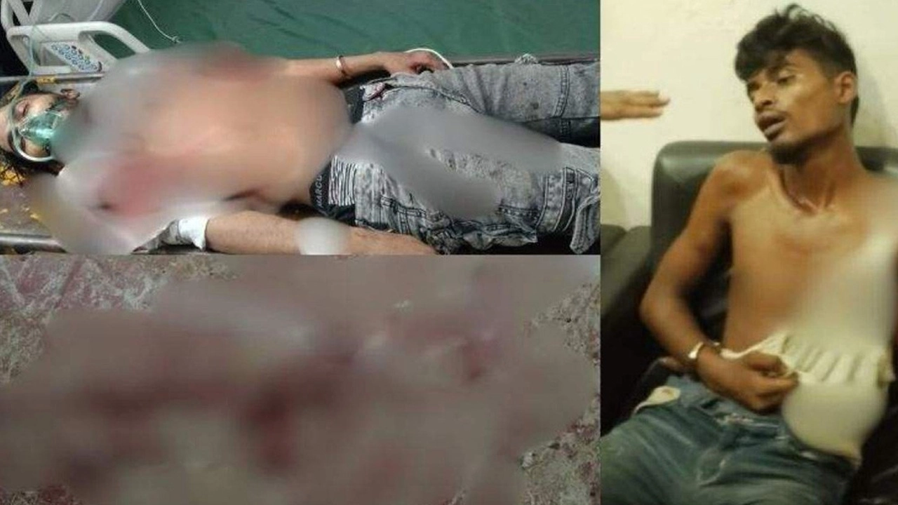 শহীদ মিনারে গুলিবিদ্ধ কন্টেন্ট ক্রিয়েটর রাকিব মারা গেছেন 