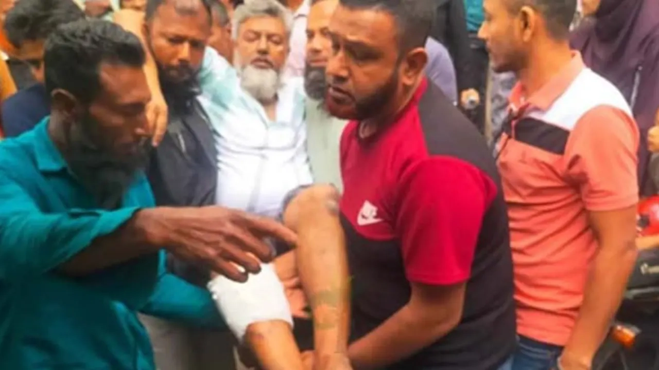 যশোরে পিটুনিতে আহত আওয়ামী লীগ নেতা 