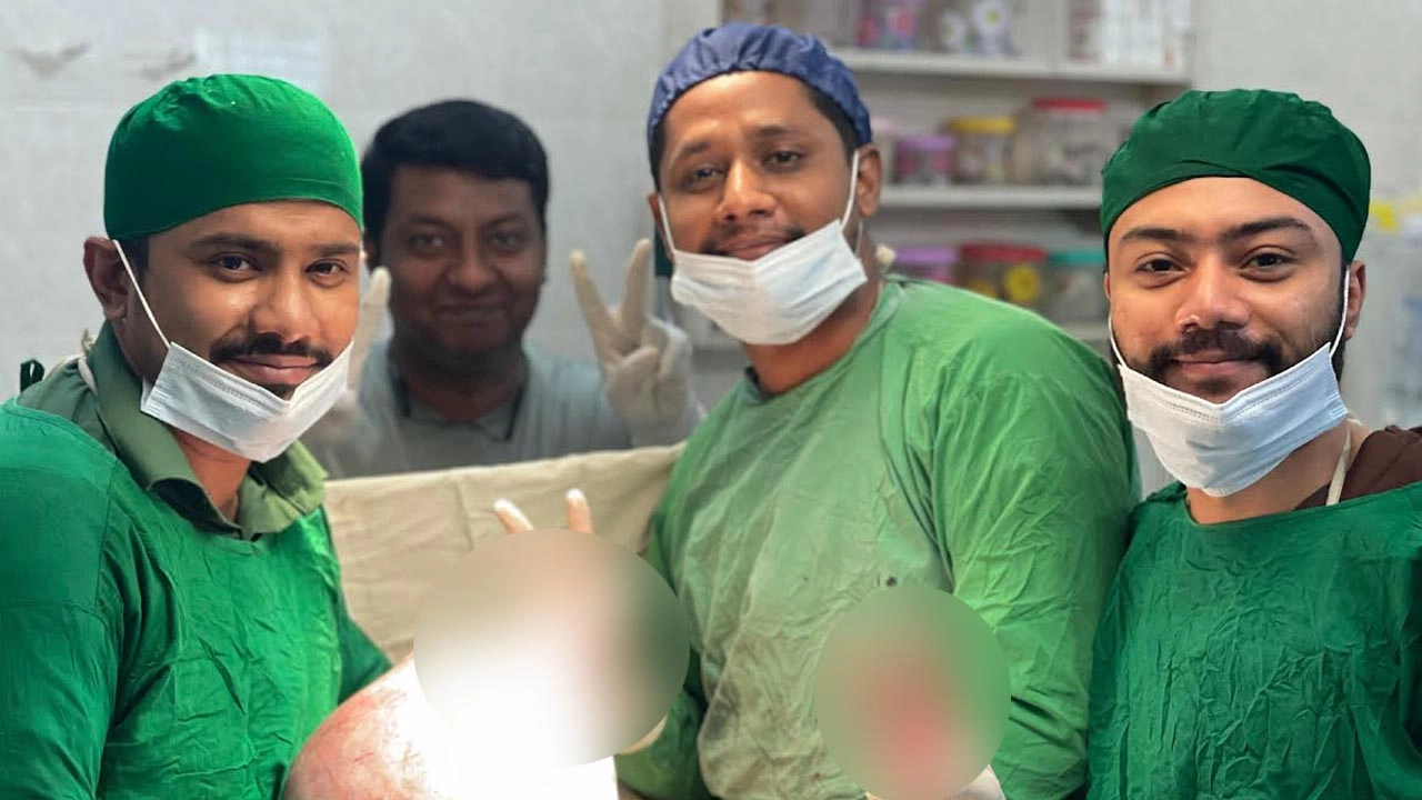 এক নারীর পেট থেকে অস্ত্রোপচারের মাধ্যমে ৮ কেজি ২০০ গ্রাম ওজনের একটি টিউমার অপসারণ করা হয়েছে।