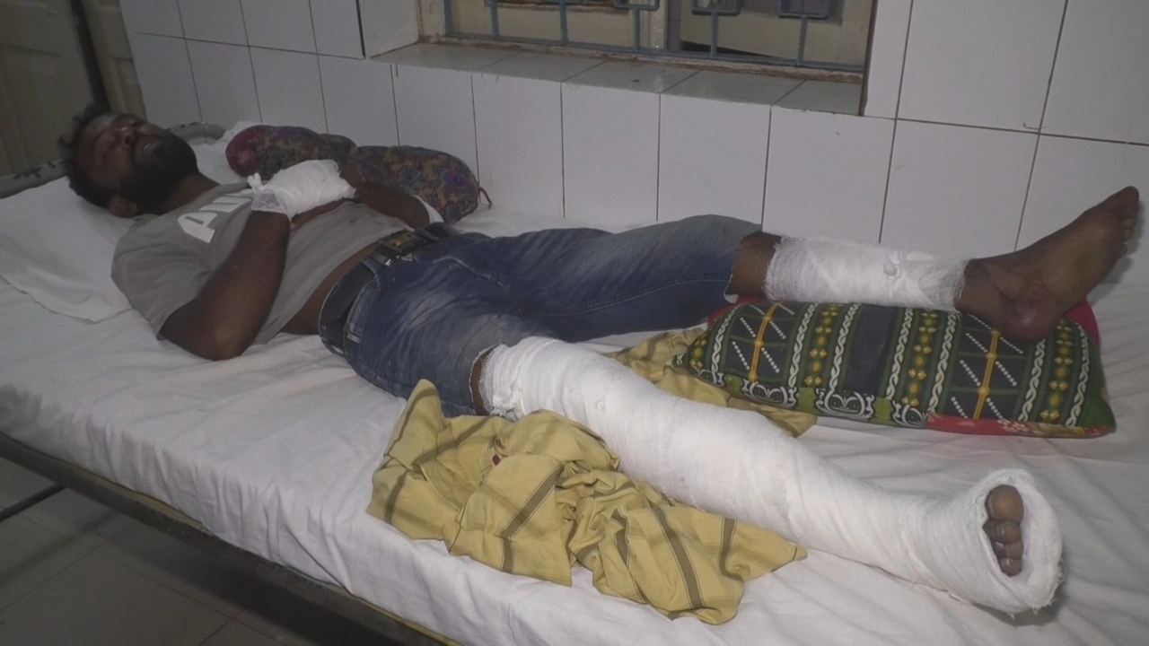 সাতক্ষীরায় এলাকায় ফিরে বিএনপি নেতার হাত-পা ভাঙল আ.লীগ নেতাকর্মী