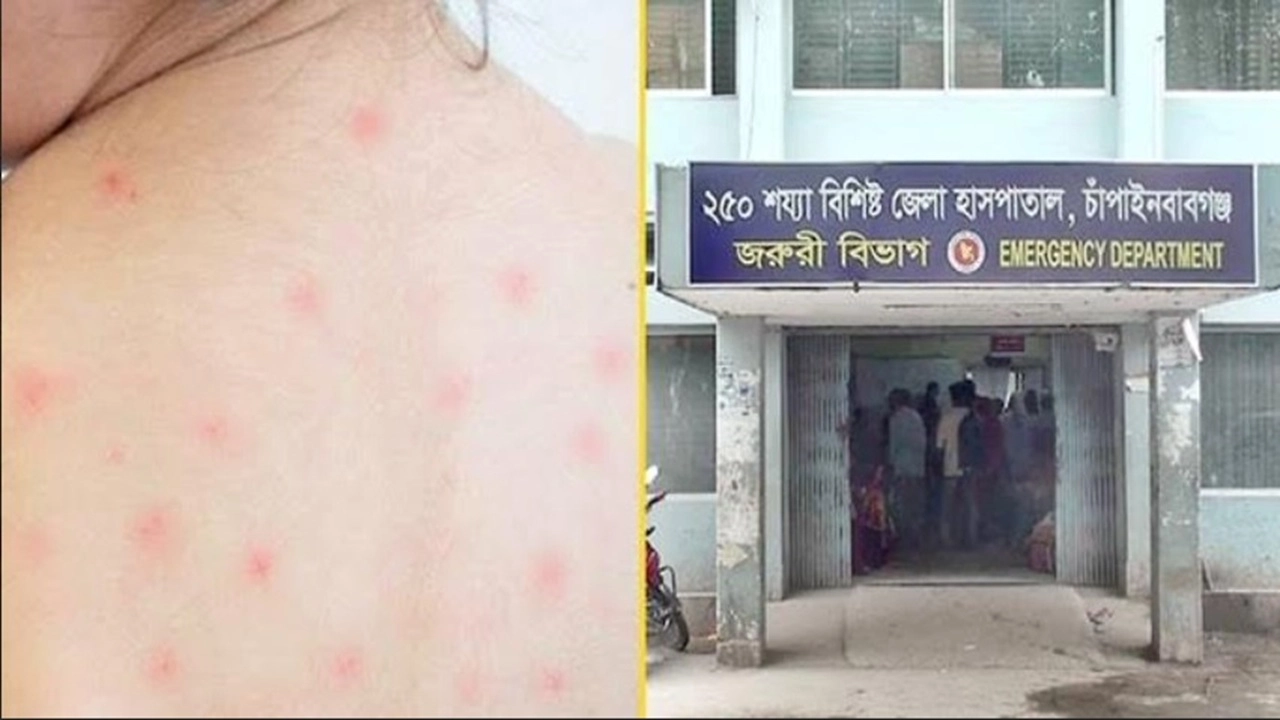 চাঁপাইনবাবগঞ্জে হামের উপসর্গ নিয়ে আরেক শিশুর মৃত্যু