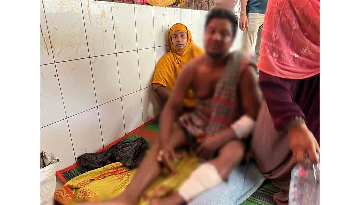 আহত রবিউল ইসলাম (৩৬)