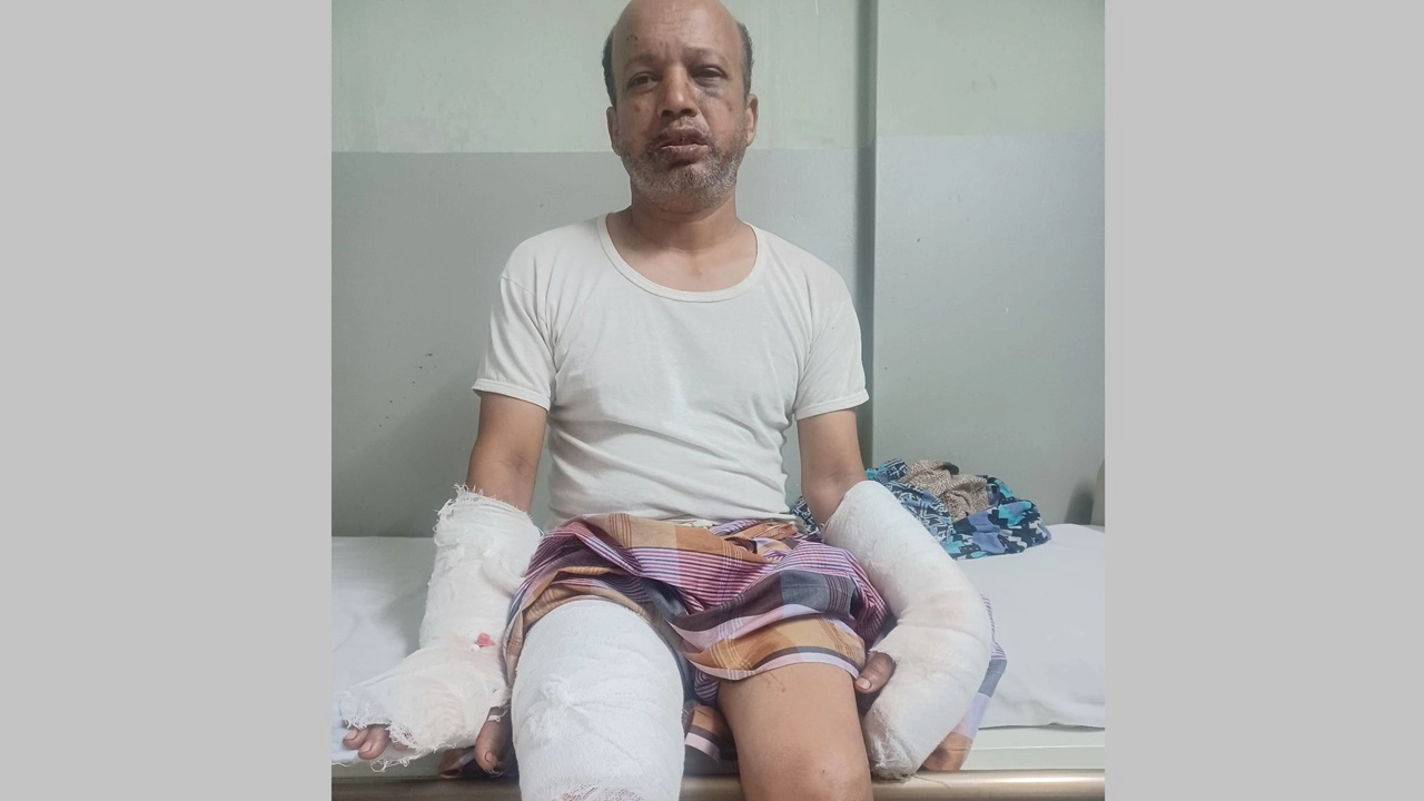 আহত প্রবাসী মো. শাহজাহান