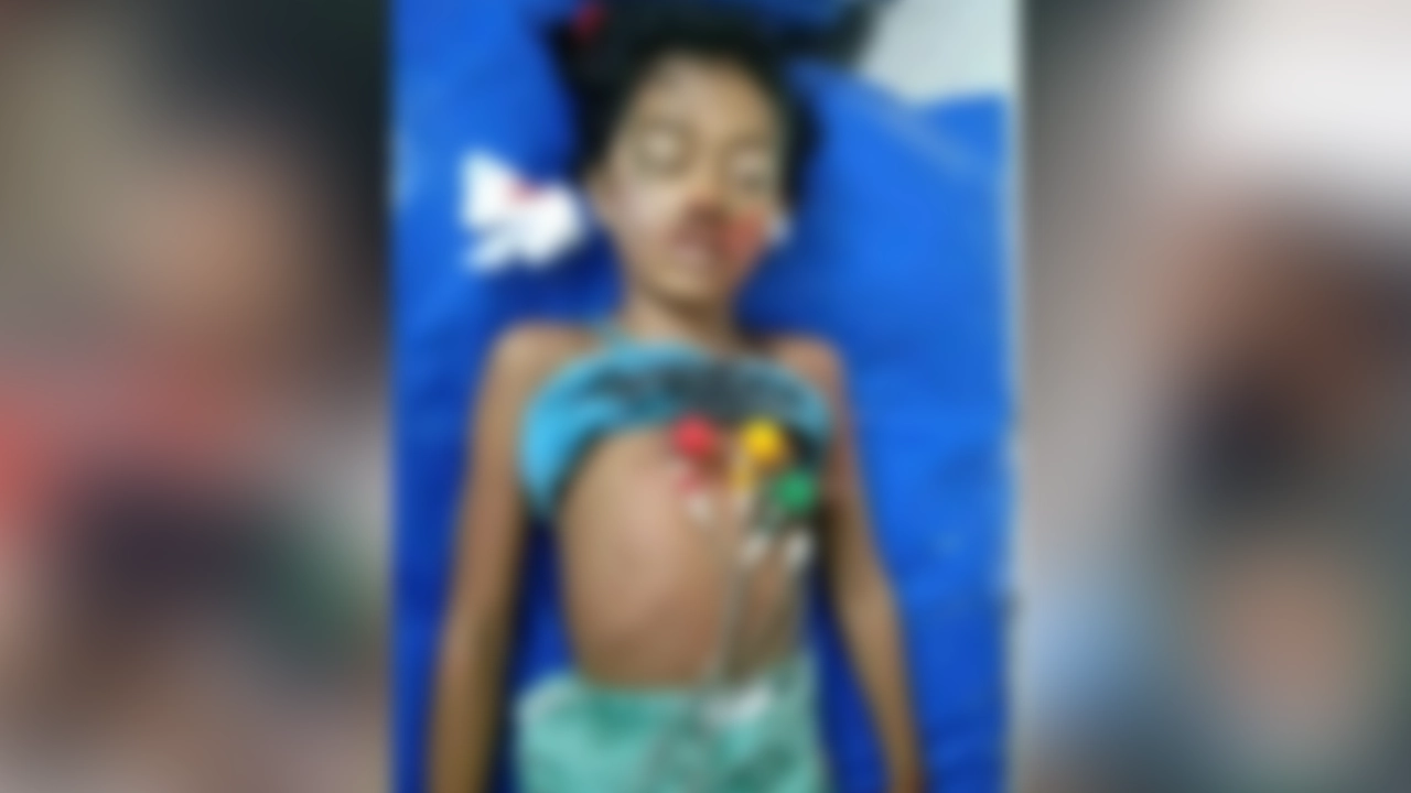 ঝড়ে তালগাছ ভেঙে শিশুর মৃত্যু