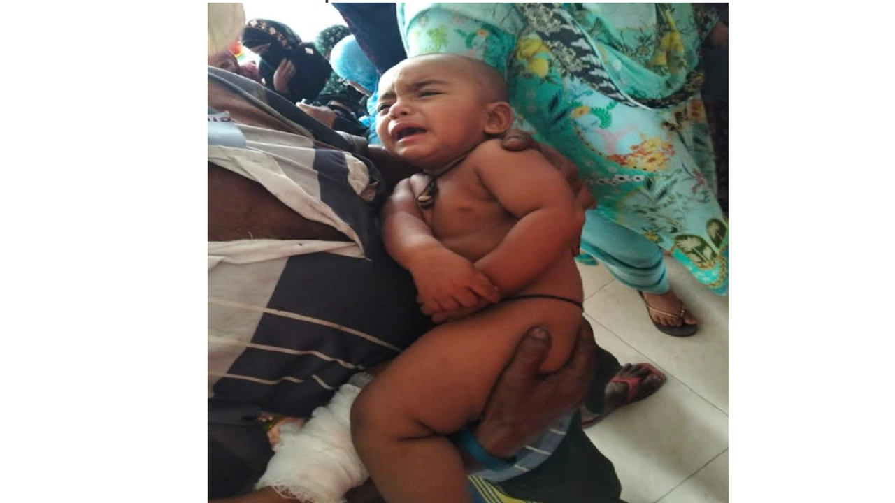 আহত ১১ মাসের শিশু