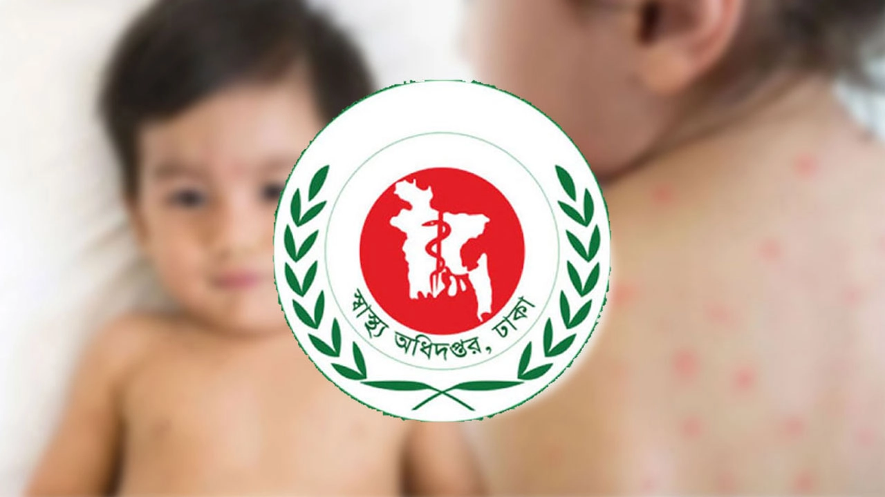 হামের উপসর্গে আরও ৪ মৃত্যু 