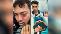 শিক্ষার্থীর চোখে গুরুতর আঘাত, মামলার তিন দিনেও গ্রেপ্তার হয়নি কেউ