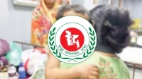 ২৪ ঘণ্টায় হামের উপসর্গে আরও ৪ জনের মৃত্যু